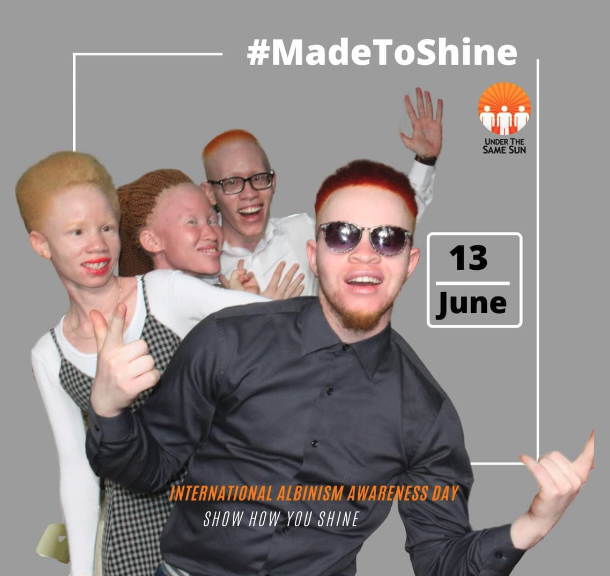 In an advertisement for International Albinism Awareness Day, a young adult activist with albinism poses for a camera wearing a dark dress shirt and sunglasses Behind him three other young adults with albinism strike similar poses.